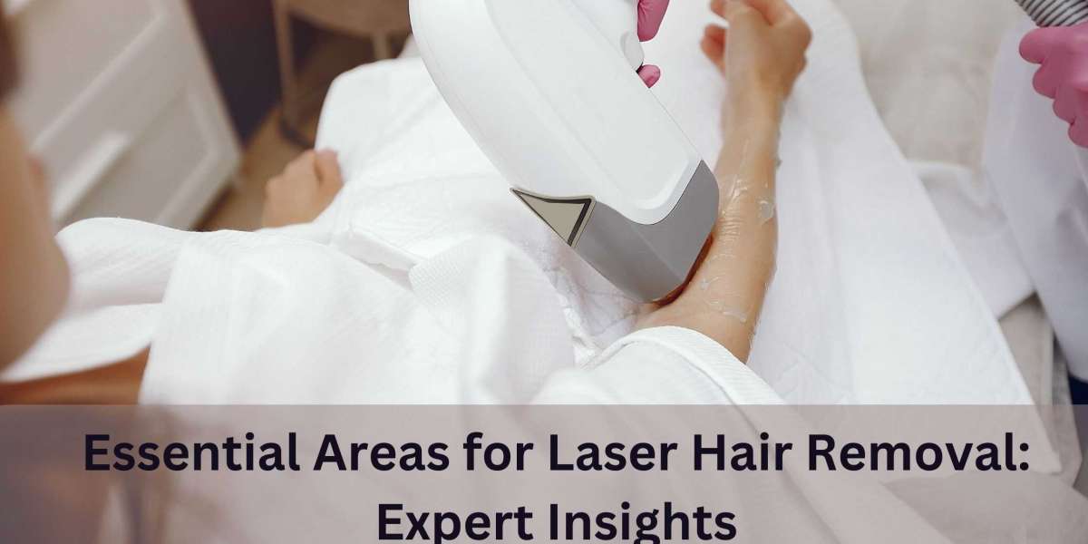 Essential Areas for Laser Hair Removal: Expert Insights